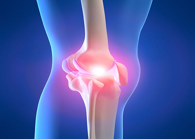 joint pain caused by knee arthrosis