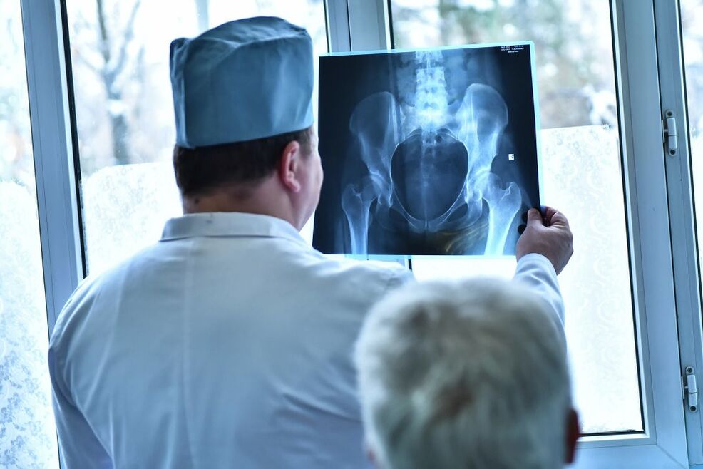 The doctor looks at the picture of the hip joint with arthrosis