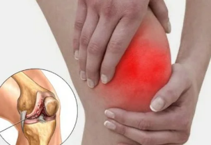 What happens when your arthritis